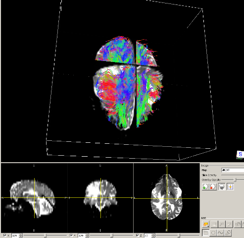 Cancer cell migration prediction