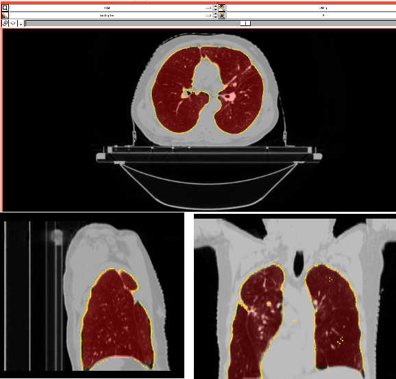 Principal curves segmentation